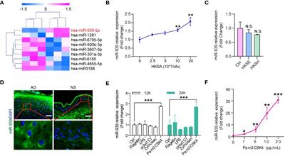 MicroRNA-939 amplifies Staphylococcus aureus-induced matrix metalloproteinase expression in atopic dermatitis